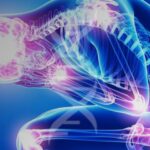 Chronic Whiplash Carries a Significant Economic Burden